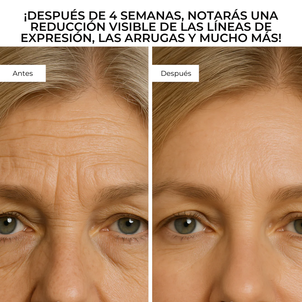 DermaGlow™ – Sistema Avanzado de Microinfusión Facial con ácido hialurónico